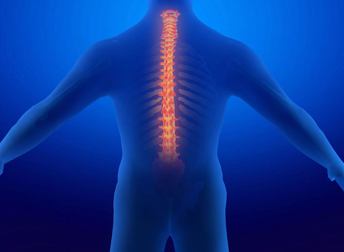 吸收不了锰得了脊柱侧凸怎么办？