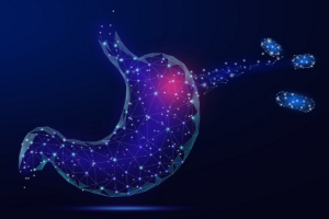 胃酸烧心需要及时警惕