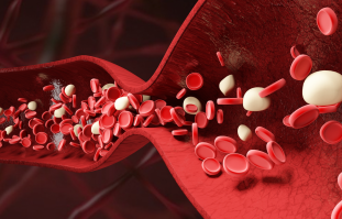 冬季防止脑梗，做好“血管畅通”四个字，更健康