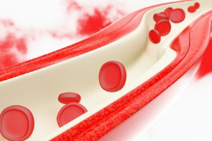 这三个地方出现疼痛，小心血管堵塞！