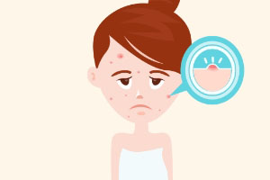 被闭口粉刺困扰多年？这几个方法一定要掌握了