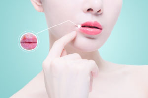 你知道吗？嘴唇也需要防晒！