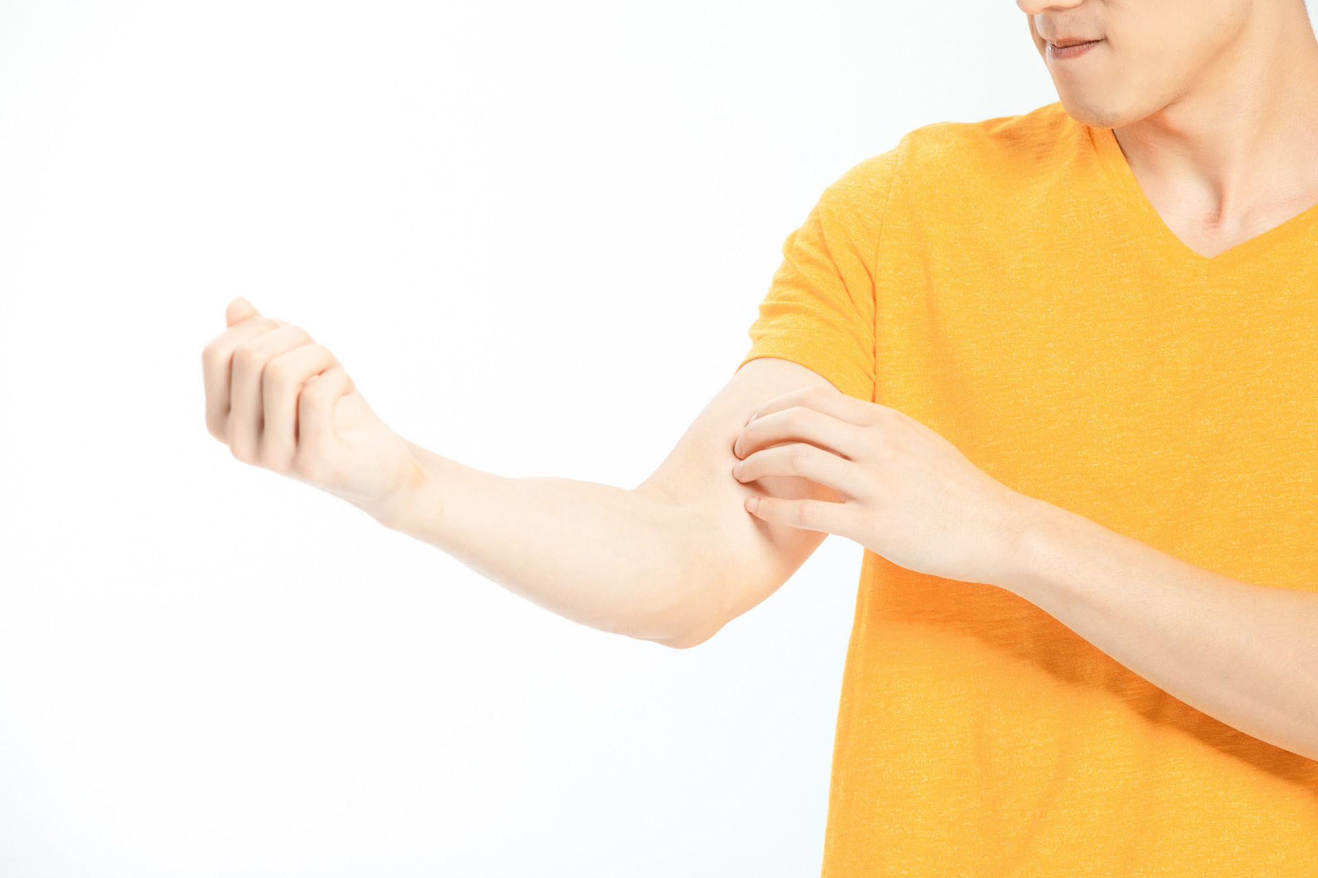 出现荨麻疹，暴饮暴食也是其中一大诱因！